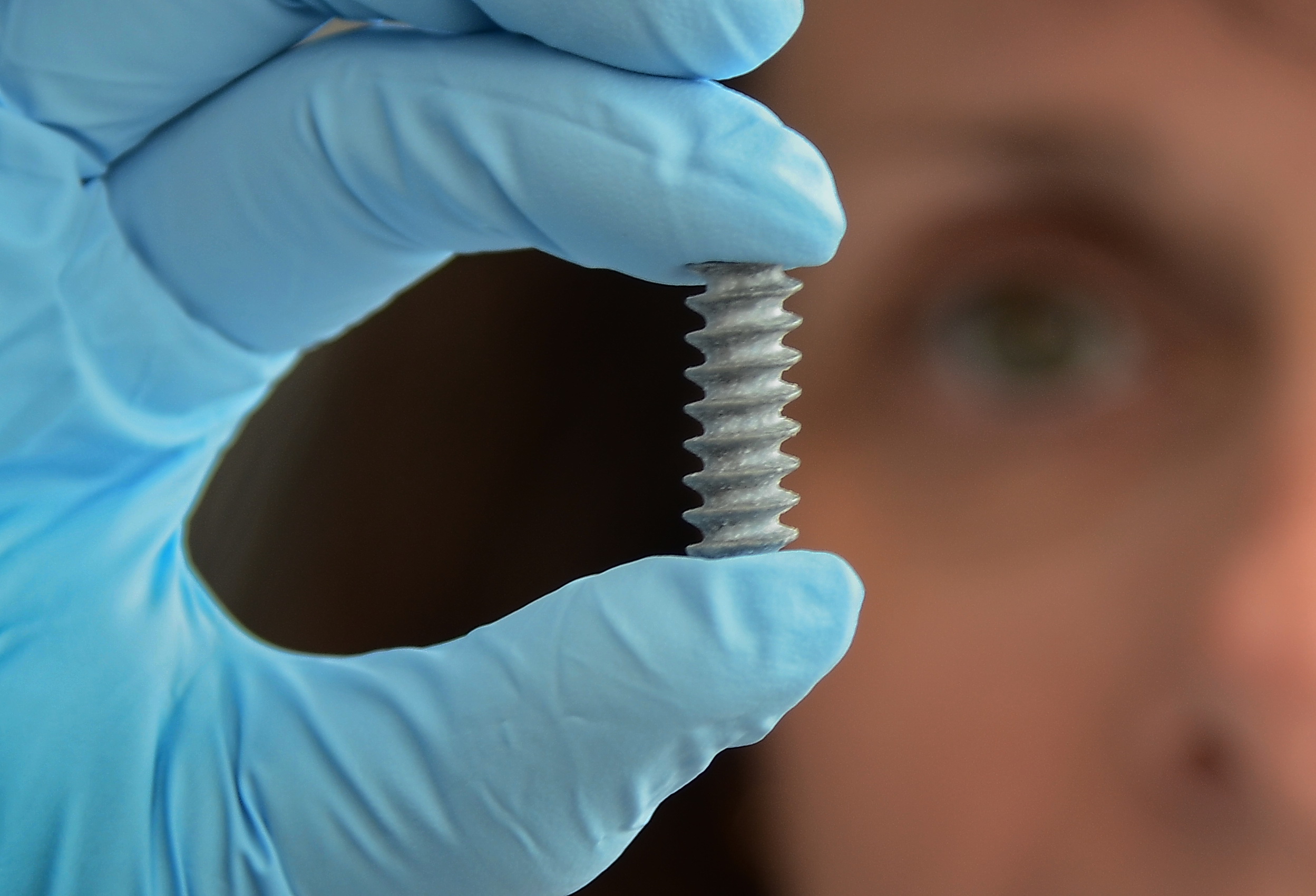 Prof. Dr. Regine Willumeit mit Magnesium Implantat